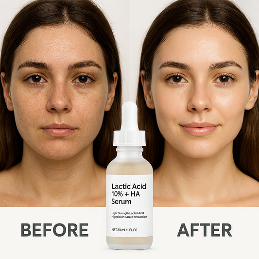 Lactic Acid 10% + Hyaluronic Acid Serum