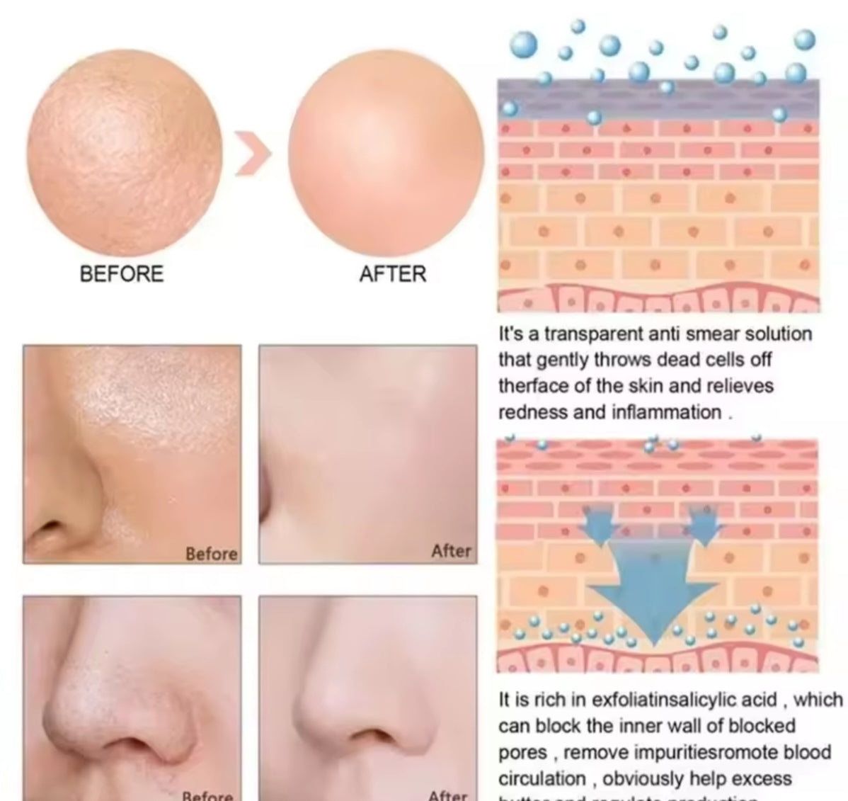 Lactic Acid 10% + Hyaluronic Acid Serum